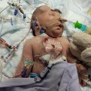 The family are struggling financially with ill newborn Palmer